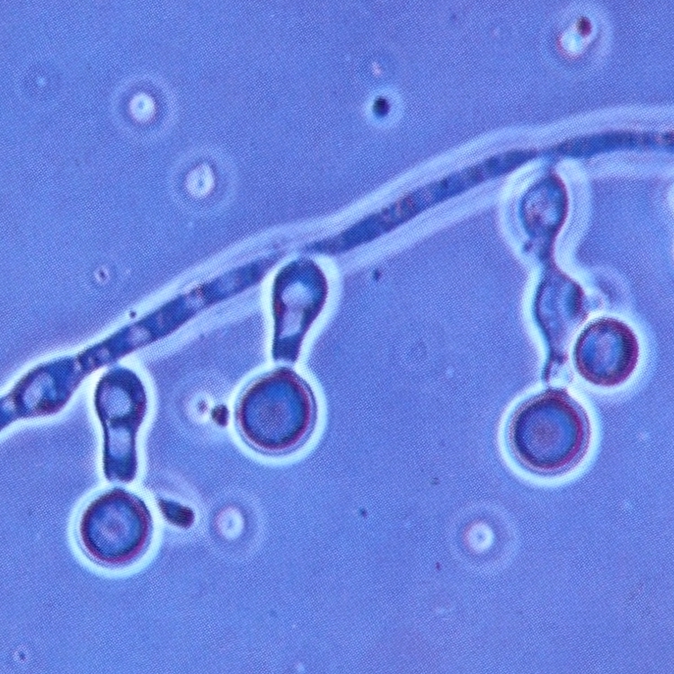 Chlamydospores. Rice agar plus Tween 80. 700x Ph