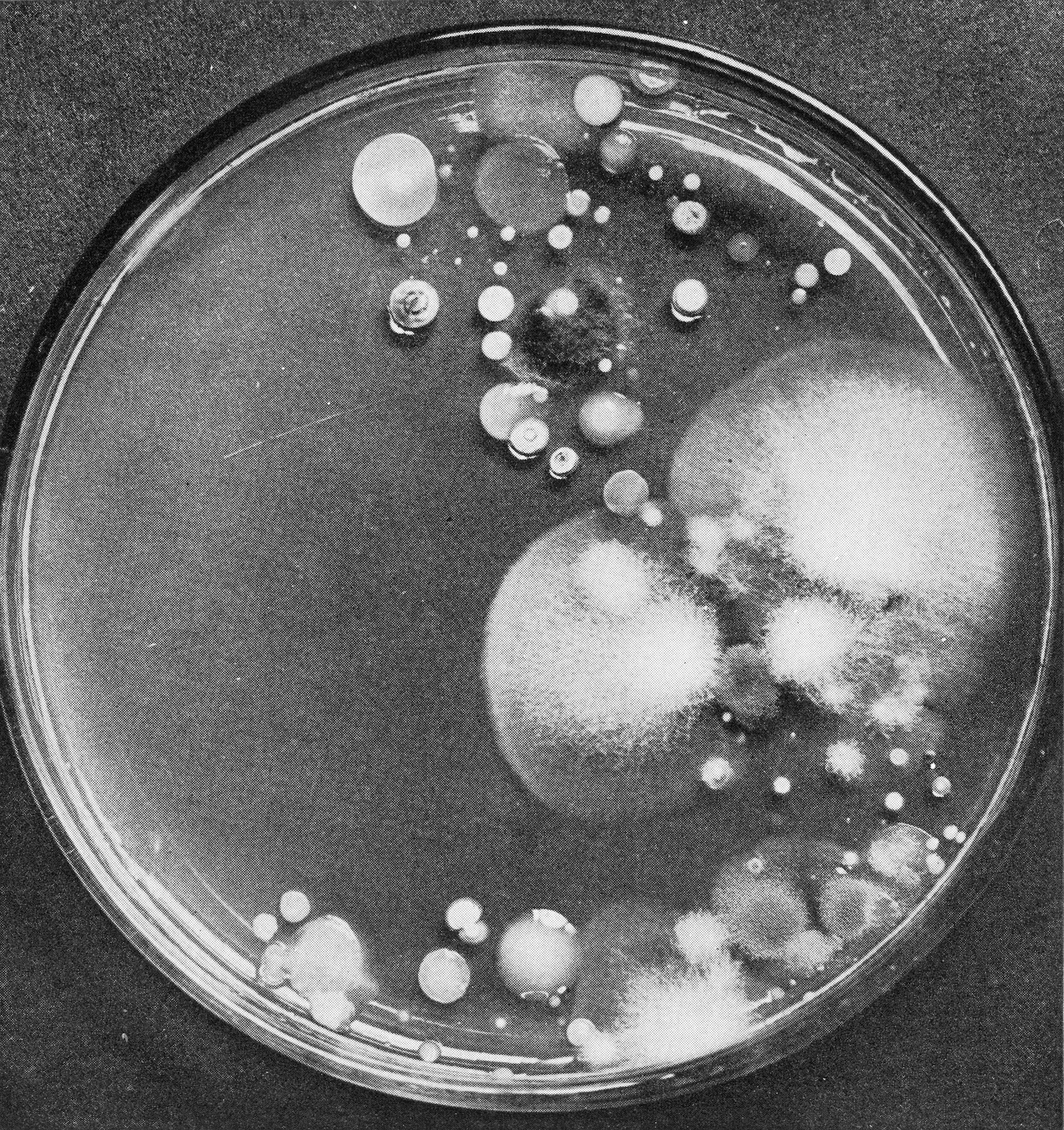 AA culture of soil extract showing colonies of various microorganisms that have grown from single spores in it