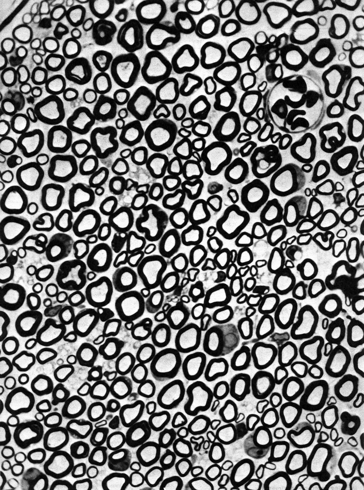 Nerve, T.S. (rat, thin section, T.S.), mag. 550x